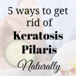 5 Ways to get rid of Keratosis Pilaris Naturally - A Fit Mom's Life